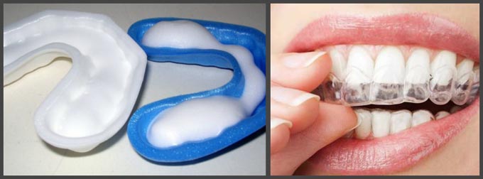 Реминерализация эмали зубов этапы