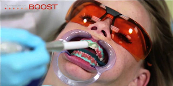 Отбеливание зубов Opalescence Boost
